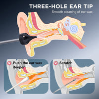 Thumbnail for EarWaxGentle™️ - Your Ultimate Ear Care Solution! - luvinly