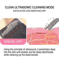 Thumbnail for GlowEase™ Skin Scrubber - Your Path to Flawless Skin! - luvinly