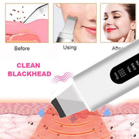 Thumbnail for GlowEase™ Skin Scrubber - Your Path to Flawless Skin! - luvinly