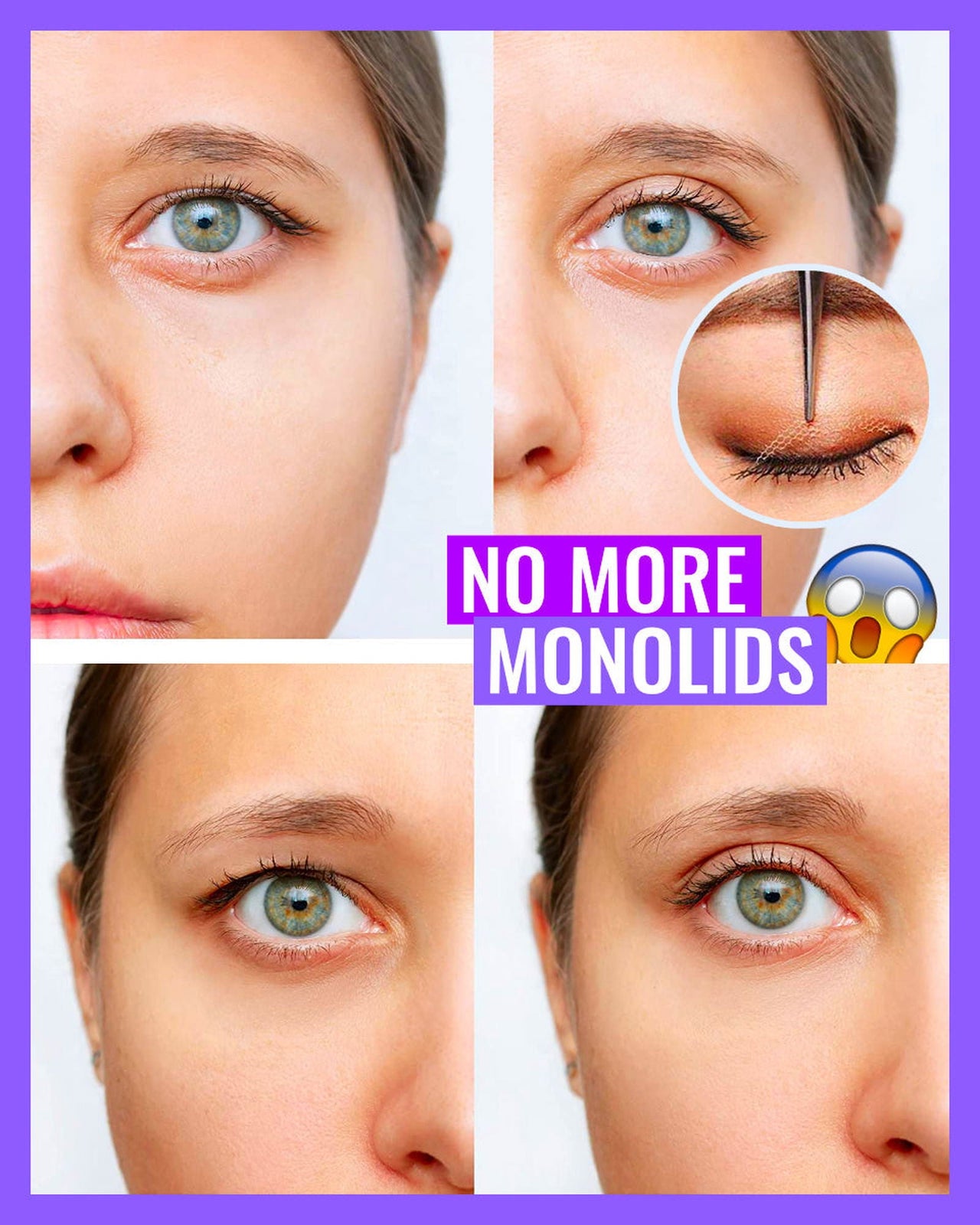 StealthLid™ - Invisible Double Eyelid Sticker - luvinly